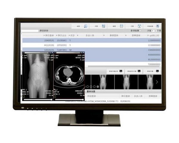 放射線学および光学画像用の医療グレードのフルHD医療ディスプレイ。